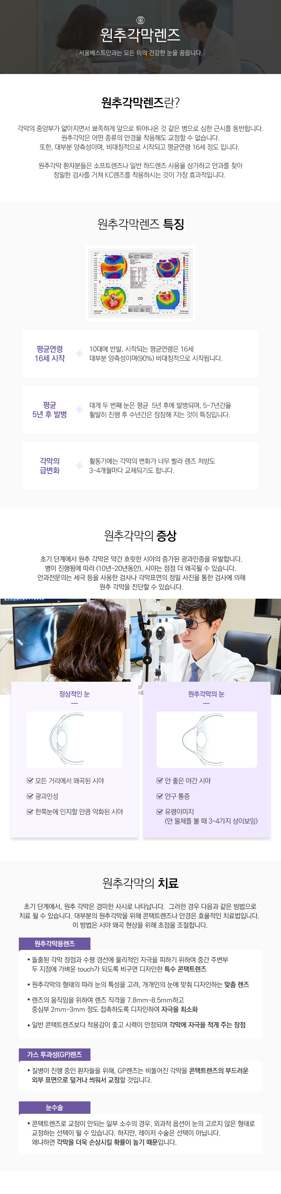 원추각막렌즈